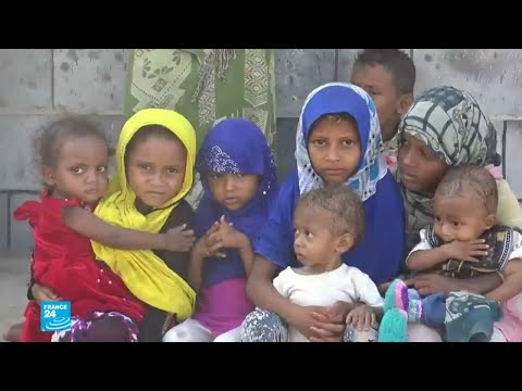 شاهد الأمم المتحدة تؤكّد أن الأزمة الإنسانية في اليمن هي الأسوأ في العالم